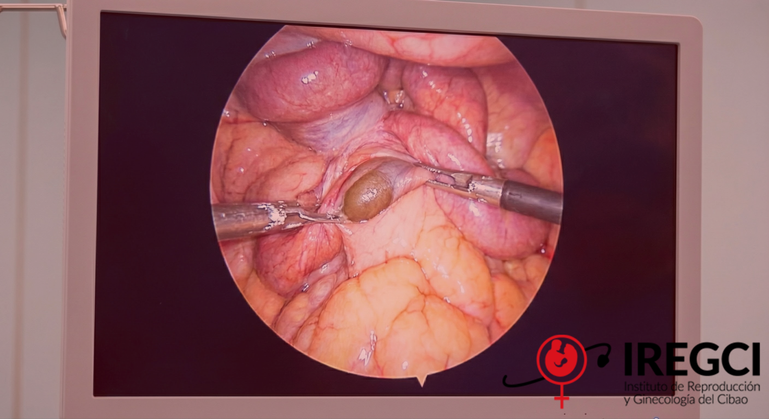 Gemini_Generated_Image_cjcphncjcphncjcp-Recovered18